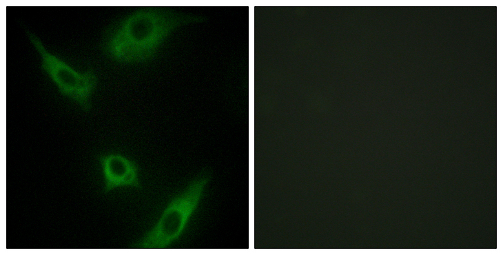 MAP3K1 / MEKK1 Antibody - Immunofluorescence analysis of HeLa cells, using MAP3K1 Antibody. The picture on the right is blocked with the synthesized peptide.