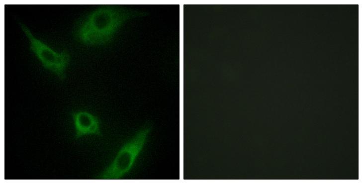 MAP3K1 / MEKK1 Antibody - Peptide - + Immunofluorescence analysis of HeLa cells, using MAP3K1 antibody.