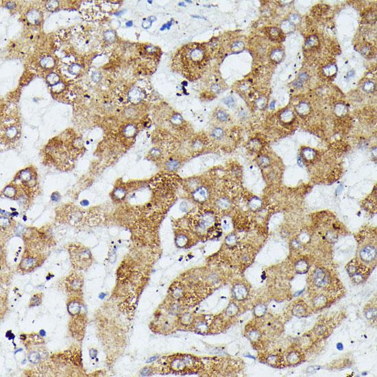 MAP3K1 / MEKK1 Antibody - Immunohistochemistry of paraffin-embedded Human liver using MAP3K1 Polyclonal Antibody at dilution of 1:100 (40x lens).
