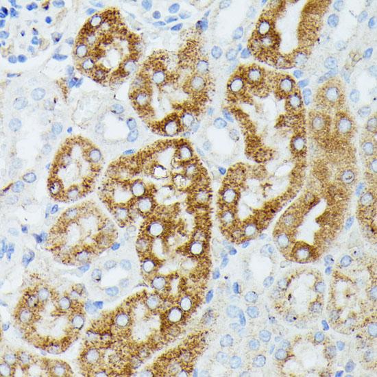 MAP3K1 / MEKK1 Antibody - Immunohistochemistry of paraffin-embedded Mouse kidney using MAP3K1 Polyclonal Antibody at dilution of 1:100 (40x lens).