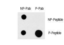 MAP3K1 / MEKK1 Antibody - Dot blot of Phospho-MAP3K1-T1400 antibody on nitrocellulose membrane. 50ng of Phospho-peptide or Non Phospho-peptide per dot were adsorbed. Antibody working concentration were 0.5ug per ml.