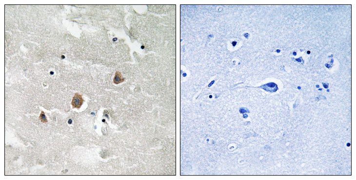 MAP3K1 / MEKK1 Antibody - Immunohistochemistry analysis of paraffin-embedded human brain, using MAP3K1 (Phospho-Thr1400) Antibody. The picture on the right is blocked with the phospho peptide.