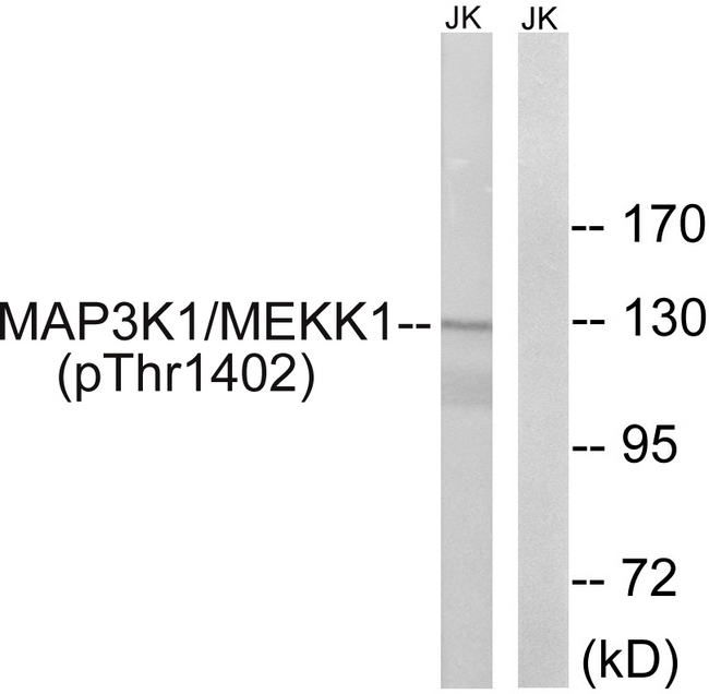 MAP3K1 / MEKK1 Antibody - Western blot analysis of lysates from Jurkat cells, using MAP3K1 (Phospho-Thr1400) Antibody. The lane on the right is blocked with the phospho peptide.