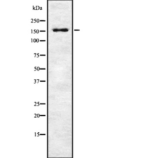 MAP3K1 / MEKK1 Antibody - Western blot analysis of Phospho-MAP3K1 (Thr1402) using K562 whole cells lysates