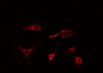 MAP3K1 / MEKK1 Antibody - Staining HeLa cells by IF/ICC. The samples were fixed with PFA and permeabilized in 0.1% Triton X-100, then blocked in 10% serum for 45 min at 25°C. The primary antibody was diluted at 1:200 and incubated with the sample for 1 hour at 37°C. An Alexa Fluor 594 conjugated goat anti-rabbit IgG (H+L) antibody, diluted at 1/600, was used as secondary antibody.