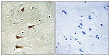 MAP3K10 / MLK2 Antibody - Immunohistochemistry analysis of paraffin-embedded human brain tissue, using MAP3K10 Antibody. The picture on the right is blocked with the synthesized peptide.