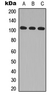 MAP3K10 / MLK2 Antibody - Western blot analysis of MLK2 expression in HeLa (A); Raw264.7 (B); H9C2 (C) whole cell lysates.