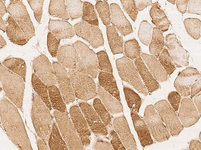 MAP3K10 / MLK2 Antibody - Immunochemical staining of human MAP3K10 in human skeletal muscle with rabbit polyclonal antibody at 1:100 dilution, formalin-fixed paraffin embedded sections.