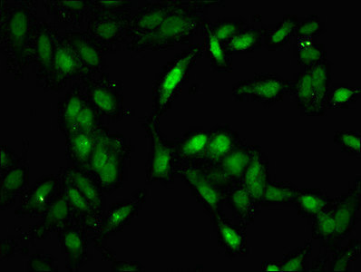 MAP3K11 / MLK3 Antibody - Immunofluorescent analysis of Hela cells at a dilution of 1:100 and Alexa Fluor 488-congugated AffiniPure Goat Anti-Rabbit IgG(H+L)