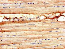 MAP3K11 / MLK3 Antibody - Immunohistochemistry image of paraffin-embedded human skeletal muscle tissue at a dilution of 1:100
