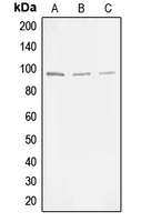 MAP3K11 / MLK3 Antibody - Western blot analysis of MLK3 (pT277/S281) expression in HEK293T (A); NIH3T3 (B); PC12 (C) whole cell lysates.