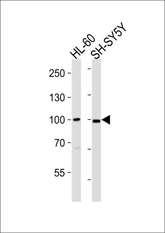 MAP3K12 Antibody - Western blot of lysates from HL-60, SH-SY5Y cell line (from left to right), using DLK Antibody(D842). Antibody was diluted at 1:1000 at each lane. A goat anti-rabbit IgG H&L (HRP) at 1:10000 dilution was used as the secondary antibody. Lysates at 35ug per lane.