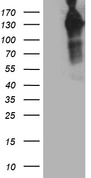 MAP3K13 / LZK Antibody - HEK293T cells were transfected with the pCMV6-ENTRY control. (Left lane) or pCMV6-ENTRY MAP3K13. (Right lane) cDNA for 48 hrs and lysed