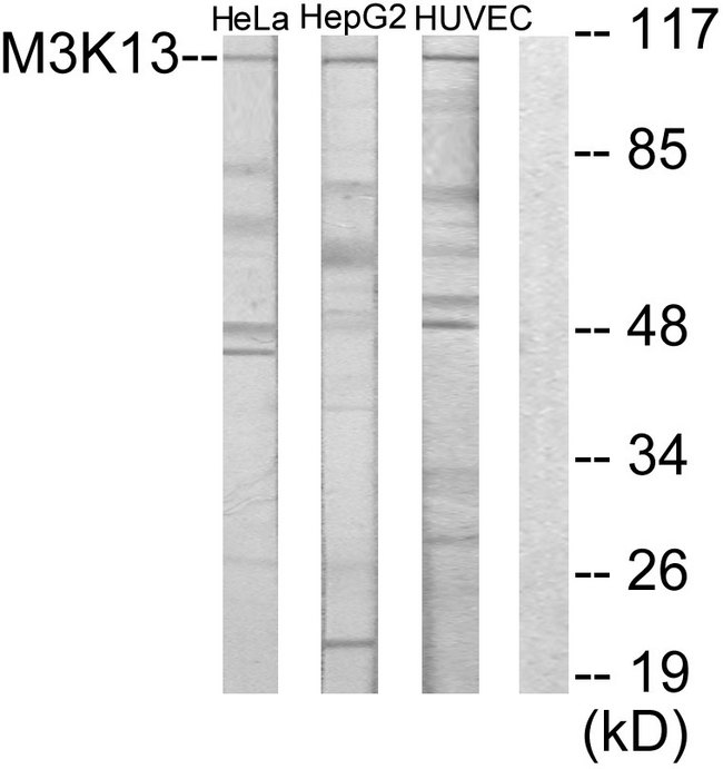 MAP3K13 / LZK Antibody - Western blot analysis of lysates from HeLa, HUVEC, and HepG2 cells, using M3K13 Antibody. The lane on the right is blocked with the synthesized peptide.