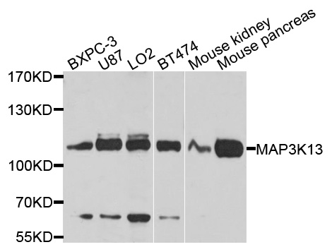 MAP3K13 / LZK Antibody - Western blot analysis of extracts of various cell lines, using MAP3K13 antibody at 1:1000 dilution. The secondary antibody used was an HRP Goat Anti-Rabbit IgG (H+L) at 1:10000 dilution. Lysates were loaded 25ug per lane and 3% nonfat dry milk in TBST was used for blocking. An ECL Kit was used for detection and the exposure time was 10s.