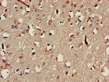 MAP3K13 / LZK Antibody - Immunohistochemistry of paraffin-embedded human brain tissue at dilution of 1:100