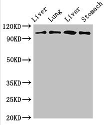 MAP3K13 / LZK Antibody - Western Blot Positive WB detected in:Rat liver tissue,Rat lung tissue,Mouse liver tissue,Mouse stomach tissue All Lanes:MAP3K13 antibody at 3µg/ml Secondary Goat polyclonal to rabbit IgG at 1/50000 dilution Predicted band size: 109,18,93,86,15 KDa Observed band size: 109 KDa