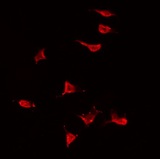 MAP3K13 / LZK Antibody - Staining HeLa cells by IF/ICC. The samples were fixed with PFA and permeabilized in 0.1% Triton X-100, then blocked in 10% serum for 45 min at 25°C. The primary antibody was diluted at 1:200 and incubated with the sample for 1 hour at 37°C. An Alexa Fluor 594 conjugated goat anti-rabbit IgG (H+L) Ab, diluted at 1/600, was used as the secondary antibody.