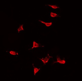 MAP3K13 / LZK Antibody - Staining HeLa cells by IF/ICC. The samples were fixed with PFA and permeabilized in 0.1% Triton X-100, then blocked in 10% serum for 45 min at 25°C. The primary antibody was diluted at 1:200 and incubated with the sample for 1 hour at 37°C. An Alexa Fluor 594 conjugated goat anti-rabbit IgG (H+L) Ab, diluted at 1/600, was used as the secondary antibody.