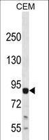 MAP3K13 / LZK Antibody - LZK Antibody western blot of CEM cell line lysates (35 ug/lane). The LZK antibody detected the LZK protein (arrow).