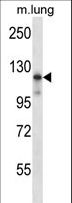 MAP3K14 Antibody - Mouse Map3k14 Antibody western blot of mouse lung tissue lysates (35 ug/lane). The Map3k14 antibody detected the Map3k14 protein (arrow).