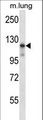 MAP3K14 Antibody - Mouse Map3k14 Antibody western blot of mouse lung tissue lysates (35 ug/lane). The Map3k14 antibody detected the Map3k14 protein (arrow).