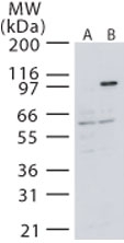 MAP3K14 Antibody - Western blot of NIK in (A) untransfected and (B) transfected 293 cells using antibody at 3 ug/ml.