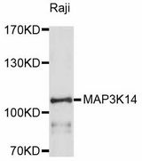 MAP3K14 Antibody - Western blot analysis of extracts of Raji cells, using MAP3K14 antibody at 1:1000 dilution. The secondary antibody used was an HRP Goat Anti-Rabbit IgG (H+L) at 1:10000 dilution. Lysates were loaded 25ug per lane and 3% nonfat dry milk in TBST was used for blocking. An ECL Kit was used for detection and the exposure time was 60s.