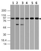 MAP3K14 Antibody - Fig-1: Western blot analysis of NIK. Anti-NIK antibody was used at 2 µg/ml on (1) Hela, (2) HepG2, (3) MOLT-4, (4) PC3, (5) RAW and (6) EL-4 lysates.