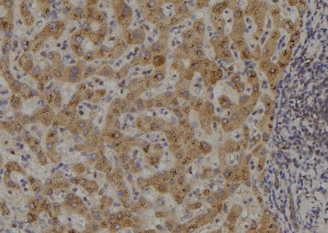 MAP3K14 Antibody - 1:100 staining human liver tissue by IHC-P. The sample was formaldehyde fixed and a heat mediated antigen retrieval step in citrate buffer was performed. The sample was then blocked and incubated with the antibody for 1.5 hours at 22°C. An HRP conjugated goat anti-rabbit antibody was used as the secondary.