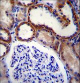 MAP3K15 / ASK3 Antibody - MAP3K15 Antibody immunohistochemistry of formalin-fixed and paraffin-embedded human kidney tissue followed by peroxidase-conjugated secondary antibody and DAB staining.