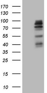 MAP3K15 / ASK3 Antibody - HEK293T cells were transfected with the pCMV6-ENTRY control. (Left lane) or pCMV6-ENTRY MAP3K15. (Right lane) cDNA for 48 hrs and lysed. Equivalent amounts of cell lysates. (5 ug per lane) were separated by SDS-PAGE and immunoblotted with anti-MAP3K15. (1:2000)