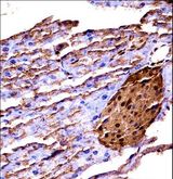 MAP3K2 / MEKK2 Antibody - Mouse Map3k2 immunohistochemistry of formalin-fixed and paraffin-embedded mouse pancreas tissue followed by peroxidase-conjugated secondary antibody and DAB staining.