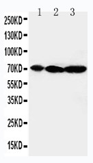 MAP3K2 / MEKK2 Antibody - WB of MAP3K2 / MEKK2 antibody. All lanes: Anti-MAP3K2 at 0.5ug/ml. Lane 1: Rat Brain Tissue Lysate at 40ug. Lane 2: Rat Testis Tissue Lysate at 40ug. Lane 3: Rat Lung Tissue Lysate at 40ug. Predicted bind size: 70KD. Observed bind size: 70KD.