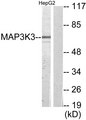MAP3K3 / MEKK3 Antibody - Western blot analysis of lysates from HepG2 cells, using MAP3K3 Antibody. The lane on the right is blocked with the synthesized peptide.