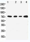 MAP3K3 / MEKK3 Antibody - WB of MAP3K3 / MEKK3 antibody. Lane 1: HELA Cell Lysate. Lane 2: A431 Cell Lysate. Lane 3: MCF-7 Cell Lysate. Lane 4: JURKAT Cell Lysate.