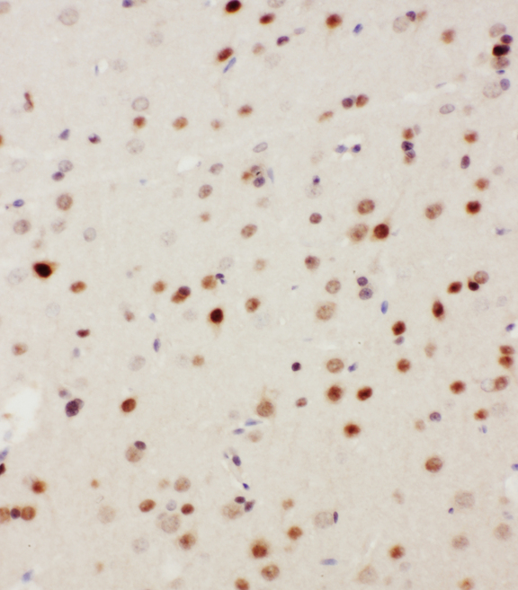 MAP3K3 / MEKK3 Antibody - MAP3K3 / MEKK3 antibody. IHC(P): Rat Brain Tissue.
