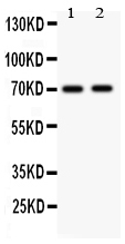 MAP3K3 / MEKK3 Antibody - Anti-MEKK3 antibody, Western blotting All lanes: Anti MAP3K3 at 0.5ug/ml Lane 1: Rat Brain Tissue Lysate at 50ugLane 2: Mouse Brain Tissue Lysate at 50ugPredicted bind size: 71KD Observed bind size: 71KD