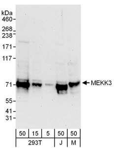 MAP3K3 / MEKK3 Antibody - Detection of Human and Mouse MEKK3 by Western Blot. Samples: Whole cell lysate from 293T (5, 15 and 50 ug), Jurkat (J; 50 ug) and mouse NIH3T3 (M; 50 ug) cells. Antibodies: Affinity purified rabbit anti-MEKK3 antibody used for WB at 0.4 ug/ml. Detection: Chemiluminescence with an exposure time of 30 seconds.