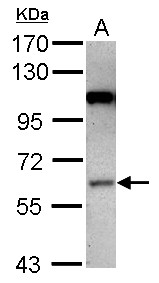 MAP3K3 / MEKK3 Antibody - Sample (30 ug of whole cell lysate) A: NT2D1 7.5% SDS PAGE MAP3K3 / MEKK3 antibody diluted at 1:1000