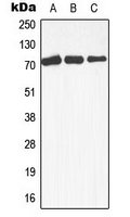 MAP3K3 / MEKK3 Antibody - Western blot analysis of MEKK3 expression in Raji (A); A431 (B); HepG2 (C) whole cell lysates.