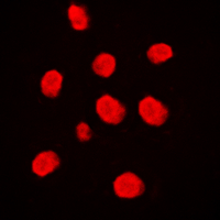 MAP3K3 / MEKK3 Antibody - Immunofluorescent analysis of MEKK3 staining in Raji cells. Formalin-fixed cells were permeabilized with 0.1% Triton X-100 in TBS for 5-10 minutes and blocked with 3% BSA-PBS for 30 minutes at room temperature. Cells were probed with the primary antibody in 3% BSA-PBS and incubated overnight at 4 C in a humidified chamber. Cells were washed with PBST and incubated with a DyLight 594-conjugated secondary antibody (red) in PBS at room temperature in the dark. DAPI was used to stain the cell nuclei (blue).