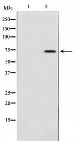 MAP3K3 / MEKK3 Antibody - Western blot of HepG2 cell lysate using MAP3K3 Antibody