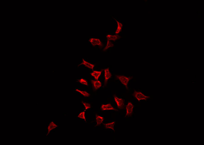 MAP3K3 / MEKK3 Antibody - Staining HepG2 cells by IF/ICC. The samples were fixed with PFA and permeabilized in 0.1% Triton X-100, then blocked in 10% serum for 45 min at 25°C. The primary antibody was diluted at 1:200 and incubated with the sample for 1 hour at 37°C. An Alexa Fluor 594 conjugated goat anti-rabbit IgG (H+L) Ab, diluted at 1/600, was used as the secondary antibody.