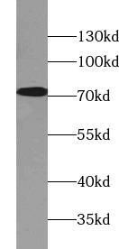 MAP3K3 / MEKK3 Antibody - Mouse liver tissue were subjected to SDS PAGE followed by western blot with MAP3K3 antibody at dilution of 1:300