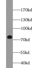 MAP3K3 / MEKK3 Antibody - Mouse liver tissue were subjected to SDS PAGE followed by western blot with MEKK3 antibody at dilution of 1:300