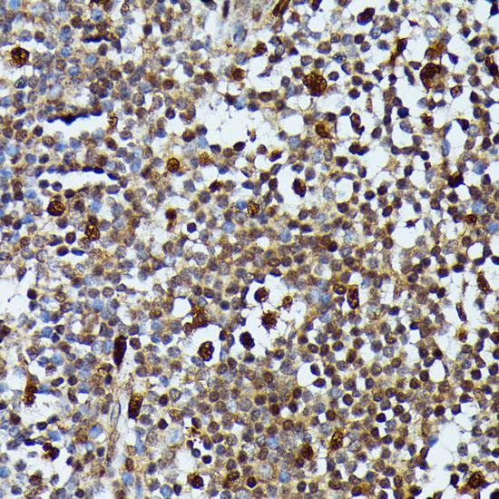 MAP3K3 / MEKK3 Antibody - Immunohistochemistry of paraffin-embedded Human appendix using MAP3K3 Polyclonal Antibody at dilution of 1:100 (40x lens).