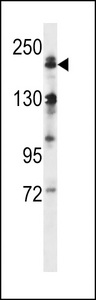 MAP3K4 / MEKK4 Antibody - MEKK4 Antibody (C1081) western blot of human normal Uterus tissue lysates (35 ug/lane). The MEKK4 antibody detected the MEKK4 protein (arrow).