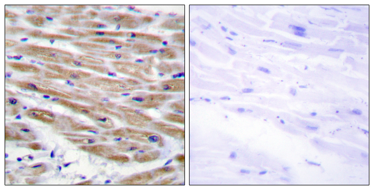 MAP3K4 / MEKK4 Antibody - Immunohistochemistry analysis of paraffin-embedded human heart tissue, using MAP3K4 Antibody. The picture on the right is blocked with the synthesized peptide.