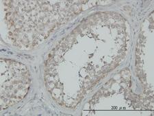MAP3K4 / MEKK4 Antibody - Immunoperoxidase of monoclonal antibody to MAP3K4 on formalin-fixed paraffin-embedded human testis. [antibody concentration 3 ug/ml]